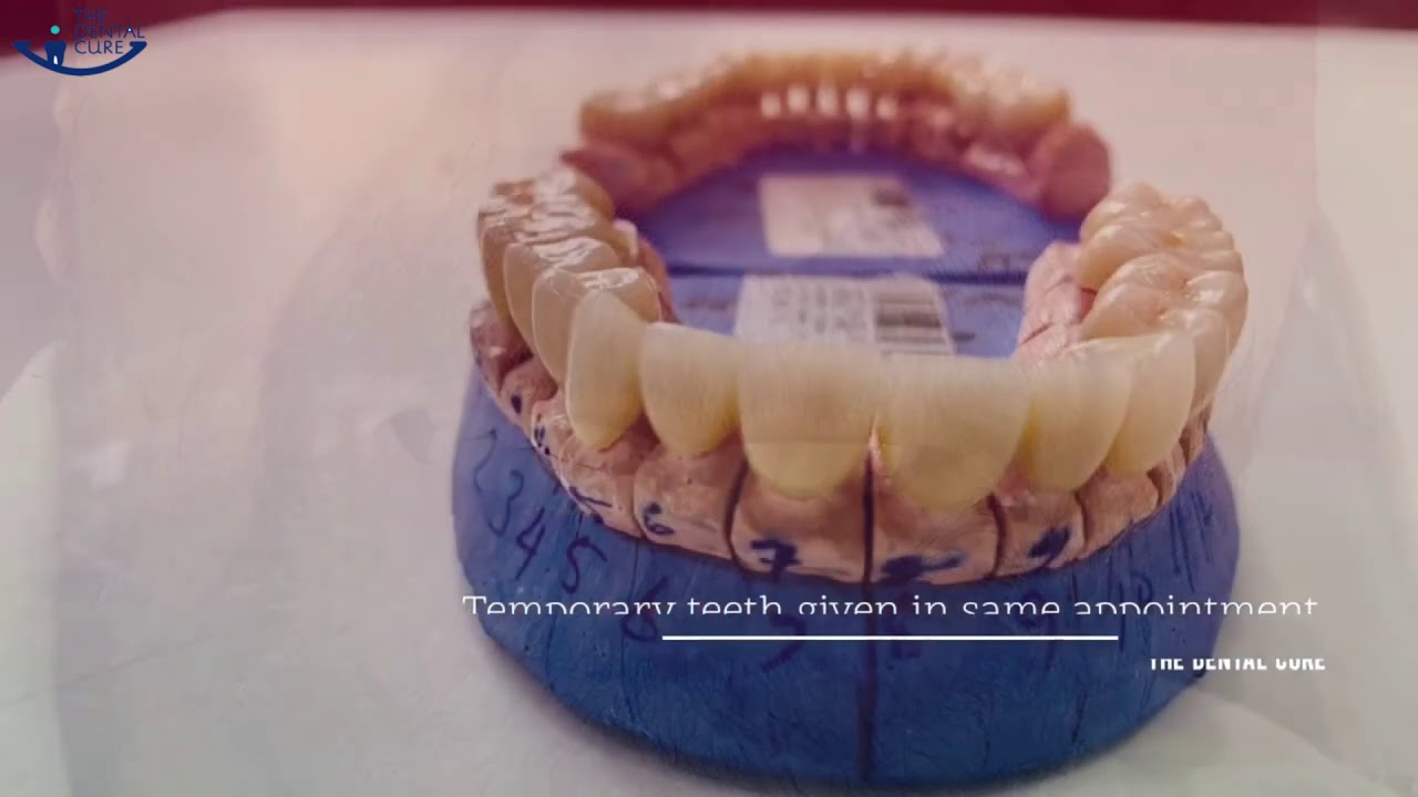 Digital Smile Design |Dr Pooja Yadav |The Dental Cure