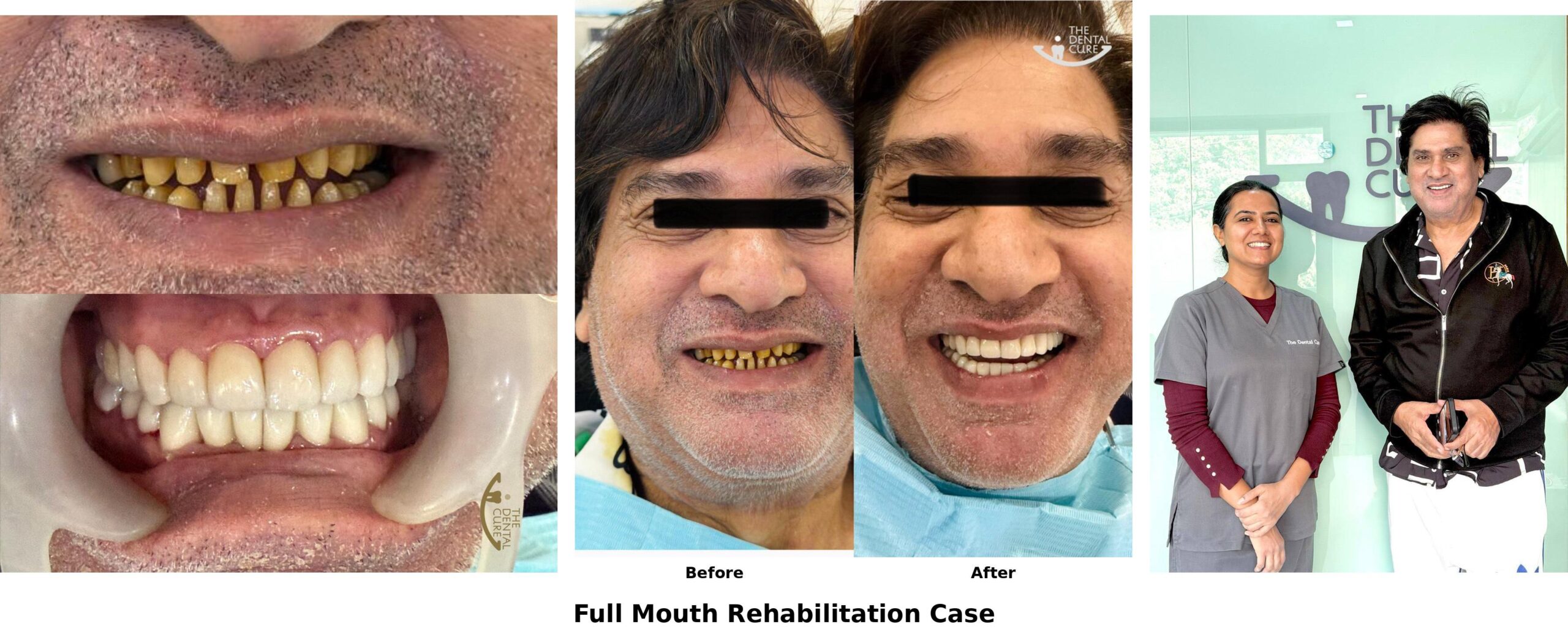 dental_collage_with_caption